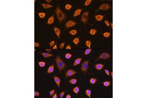 Immunofluorescence analysis of L929 cells using SDHB Rabbit pAb (ABIN6131588, ABIN6147472, ABIN6147474 and ABIN6215002) at dilution of 1:100.