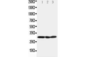 Anti-COMT antibody, Western blotting Lane 1: HELA Cell Lysate Lane 2: A375 Cell Lysate Lane 3: PANC Cell Lysate (COMT anticorps  (N-Term))