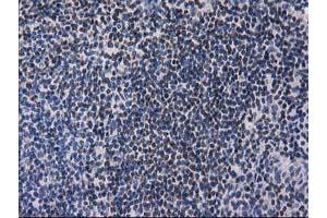 Immunohistochemistry (IHC) image for anti-Ankyrin Repeat Domain 53 (ANKRD53) (AA 1-300) antibody (ABIN1490720) (ANKRD53 anticorps  (AA 1-300))