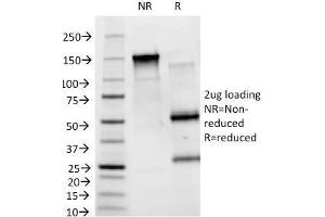 SDS-PAGE Analysis Purified Blood Group B Monoclonal Antibody (HEB-20). (ABO anticorps)