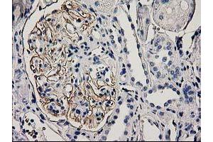 Immunohistochemical staining of paraffin-embedded Human Kidney tissue using anti-PDLIM2 mouse monoclonal antibody. (PDLIM2 anticorps)