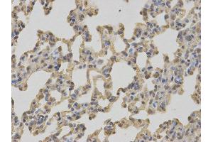 Immunohistochemistry (IHC) image for anti-Complement Component 1, Q Subcomponent Binding Protein (C1QBP) antibody (ABIN1871379) (C1QBP anticorps)