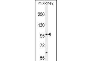 MED25 Antibody (N-term) (ABIN654162 and ABIN2844026) western blot analysis in mouse kidney tissue lysates (35 μg/lane). (MED25 anticorps  (AA 112-140))