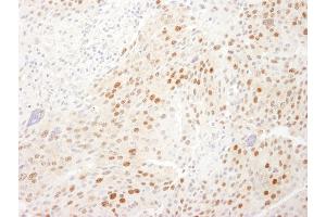 Immunohistochemistry (IHC) image for anti-WD Repeat Domain 77 (WDR77) (AA 1-50) antibody (ABIN7453513)