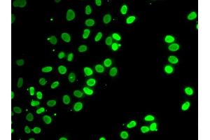 Immunofluorescence analysis of HeLa cells using SEPT7 antibody (ABIN6291642). (Septin 7 anticorps)