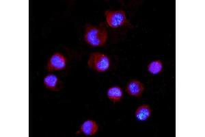 IF analysis of CD16 using anti-CD16 antibody (ABIN5693196).