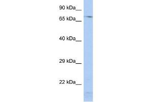 WB Suggested Anti-SRP72 Antibody Titration:  0. (SRP72 anticorps  (Middle Region))