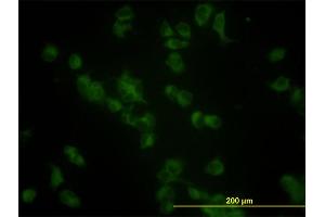 Immunofluorescence of monoclonal antibody to GBA on HeLa cell.