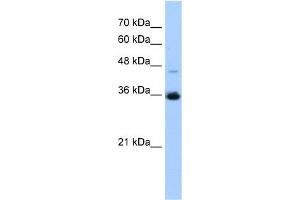 WB Suggested Anti-GGPS1 Antibody Titration:  0. (GGPS1 anticorps  (C-Term))