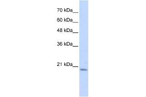 PFDN6 antibody used at 1 ug/ml to detect target protein. (PFDN6 anticorps  (N-Term))