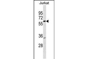 Western blot analysis in Jurkat cell line lysates (35ug/lane). (PKNOX2 anticorps  (AA 298-324))