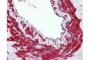 Anti-TRPM8 antibody IHC of human lung, vessel. (TRPM8 anticorps  (N-Term))