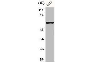 Western Blot analysis of HuvEc cells using ADCK5 Polyclonal Antibody (ADCK5 anticorps  (Internal Region))