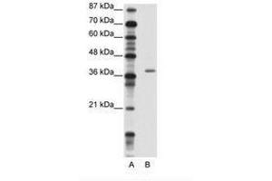 Image no. 1 for anti-Zinc Finger Protein 444 (ZNF444) (AA 251-300) antibody (ABIN202253) (ZNF444 anticorps  (AA 251-300))