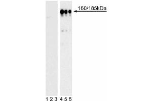 Western blot analysis of IRS-1 (pY896) in transformed human epithelial cells. (IRS1 anticorps  (pTyr896))