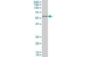 IRX3 monoclonal antibody (M03), clone 3D8 Western Blot analysis of IRX3 expression in K-562 .