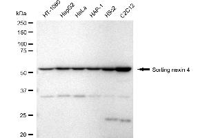 Western blotting analysis using sorting nexin 4 antibody (ABIN7800409). (Recombinant Sorting Nexin 4 anticorps)