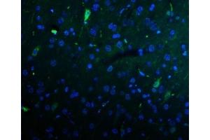 IF analysis of KCNA1 using anti-KCNA1 antibody (ABIN6719578).