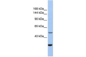 ZZZ3 antibody used at 0.