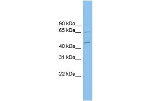 WB Suggested Anti-MDH1B Antibody Titration: 0. (MDH1B anticorps  (Middle Region))