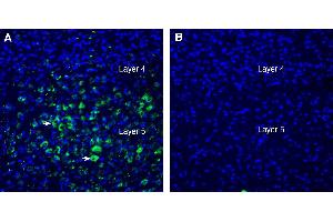 Expression of LRRTM2 in mouse parietal cortex.