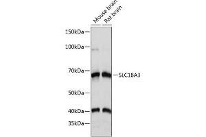 Western blot analysis of extracts of various cell lines, using SLC18 Polyclonal Antibody (ABIN7270410) at 1:1000 dilution. (SLC18A3 anticorps  (AA 1-150))