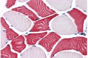 Human Skeletal Muscle (formalin-fixed, paraffin-embedded) stained with EBAG9 antibody ABIN351484 at 3. (RCAS1 anticorps  (AA 240-251))