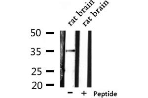 Western blot analysis of extracts from rat brain, using OR6N1 Antibody.