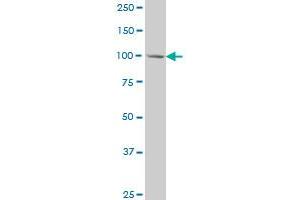 MCM3 monoclonal antibody (M03), clone 3E1 Western Blot analysis of MCM3 expression in HeLa .