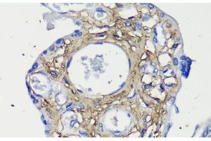 Immunohistochemistry of paraffin-embedded Human placenta using Decorin Polyclonal Antibody at dilution of 1:200 (40x lens).
