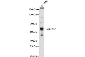 Western blot analysis of extracts of U-87MG cells, using SLC17 antibody (ABIN6127303, ABIN6147863, ABIN6147864 and ABIN6216671) at 1:1000 dilution.