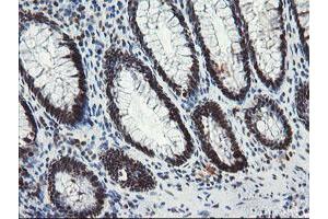 Image no. 10 for anti-TP53RK Binding Protein (TPRKB) antibody (ABIN1501484)
