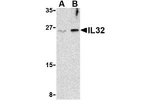 Image no. 1 for anti-Interleukin 32 (IL32) (Middle Region) antibody (ABIN318795) (IL32 anticorps  (Middle Region))