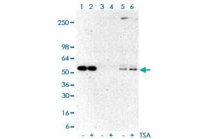 Immunoprecipitation analysis of Lane 1: A431 cell whole lysates, Lane 2: TSA-treated A431 cell whole lysates; Lane 3: A431 cell whole lysates, Lane 4: TSA-treated A431 cell whole lysates using rabbit IgG antibody; Lane 5: A431 cell whole lysates, Lane 6: TSA-treated A431 cell whole lysates using Acetylated-Lysine monoclonal antibody, clone RM101  at 1:500 dilution. (Acetylated Lysine anticorps  (acetylated))