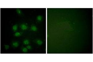 Immunofluorescence analysis of HuvEc cells, using NIFK (Phospho-Thr234) Antibody. (NIFK anticorps  (pThr234))