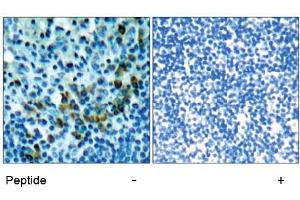 Image no. 1 for anti-zeta-Chain (TCR) Associated Protein Kinase 70kDa (ZAP70) (Tyr319) antibody (ABIN197384) (ZAP70 anticorps  (Tyr319))