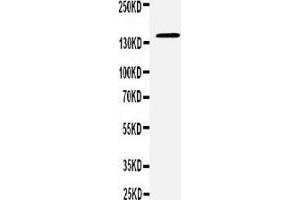 Anti-CD22 antibody,  Western blotting WB: RAJI Cell Lysate (CD22 anticorps  (C-Term))