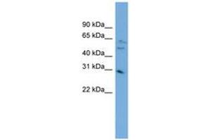 Image no. 1 for anti-mRNA Turnover 4 Homolog (MRTO4) (AA 143-192) antibody (ABIN6744820) (C1orf33 anticorps  (AA 143-192))