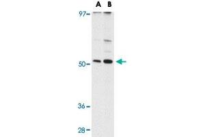 Western blot analysis of MATN3 in NIH/3T3 cell lysate with MATN3 polyclonal antibody  at (A) 1 and (B) 2 ug/mL . (Matrilin 3 anticorps  (C-Term))