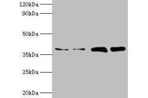 Western blot All lanes: TBCC antibody at 2 μg/mL Lane 1: Hela whole cell lysate Lane 2: HepG2 whole cell lysate Lane 3: A549 whole cell lysate Lane 4: MCF-7 whole cell lysate Secondary Goat polyclonal to rabbit IgG at 1/10000 dilution Predicted band size: 40 kDa Observed band size: 40 kDa (TBCC anticorps  (AA 2-346))