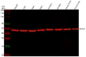 Western blot analysis of eIF4A2 using anti-eIF4A2 antibody (ABIN3043426). (EIF4A2 anticorps  (N-Term))
