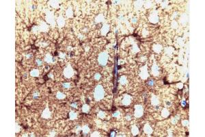 Glutamine synthetase staining on a rat cerebrum section. (GLN1 anticorps  (AA 1-373))