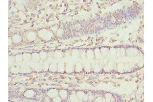 Immunohistochemistry of paraffin-embedded human colon tissue using ABIN7156305 at dilution of 1:100