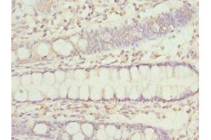 Immunohistochemistry of paraffin-embedded human colon tissue using ABIN7156305 at dilution of 1:100 (IP6K2 anticorps  (AA 1-180))