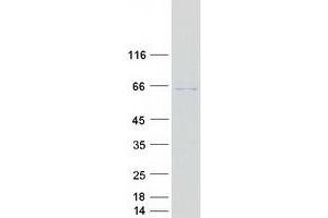 Validation with Western Blot