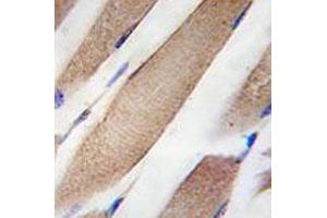Immunohistochemical staining of formalin-fixed and paraffin-embedded human skeletal muscle tissue reacted with CLIC4 monoclonal antibody  at 1:50-1:100 dilution.