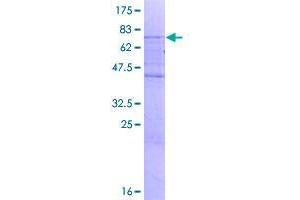 Image no. 1 for Small ArfGAP2 (SMAP2) (AA 1-429) protein (GST tag) (ABIN1320620)
