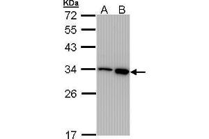 WB Image Sample (30 ug of whole cell lysate) A: 293T B: A431 , 12% SDS PAGE antibody diluted at 1:1000 (RPA2 anticorps)
