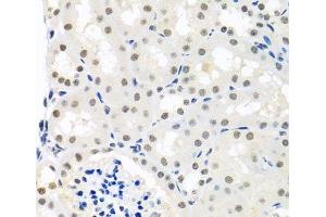 Immunohistochemistry of paraffin-embedded Mouse kidney using THOC1 Polyclonal Antibody at dilution of 1:100 (40x lens). (THOC1 anticorps)