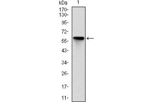 Western blot analysis using ROCK1 antibody against HEK293 (1) and ROCK1 (AA: 403-610) -hIgGFc transfected HEK293 (2) cell lysate.